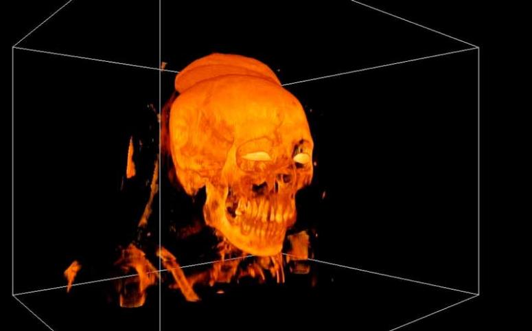 New technology unwraps mummies’ ancient mysteries