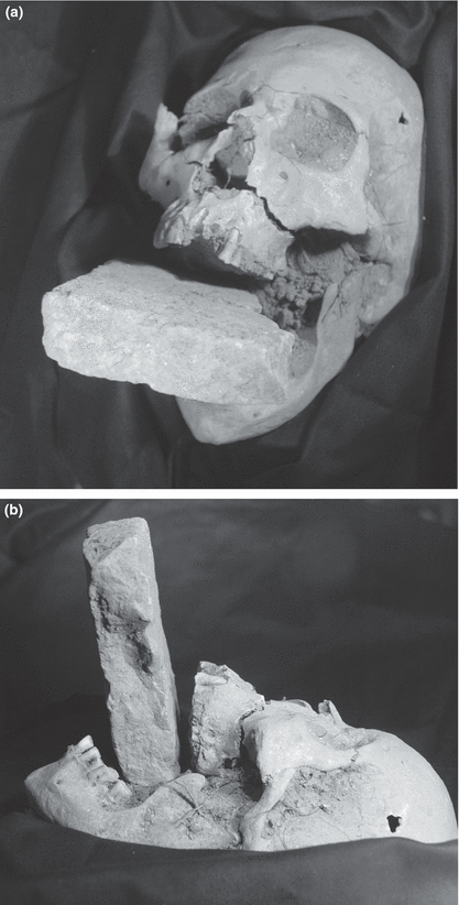 The strange case of the “vampire” burial in Venice.