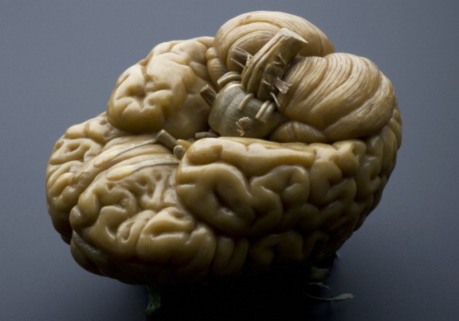 What Happens If You Apply Electricity to the Brain of a Corpse?