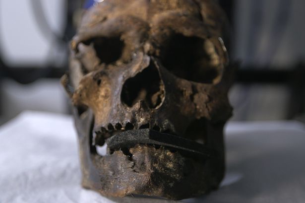University of Manchester Worsley Man: Scan reveals evidence of ritual human sacrifice in Salford