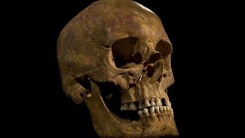Richard III had scoliosis, not a hunched back