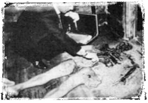 The Combustible Countess: Spontaneous Ignition of the Lady Goerlitz