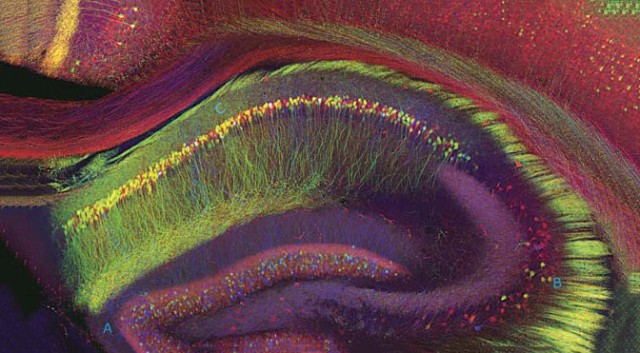 Scientists discover the on-off switch for human consciousness deep within the brain