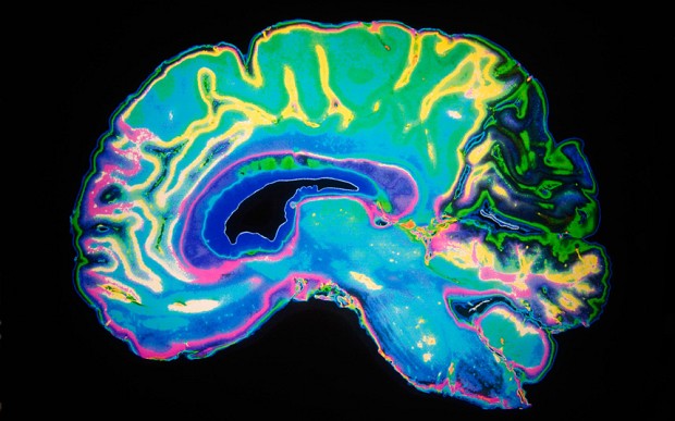 The Tale of the Dueling Neurosurgeons by Sam Kean, review: ‘entertainingly gothic’