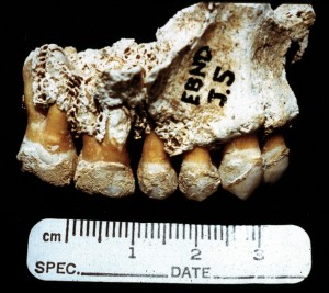 It’s the Tooth: Dental Remains & Archaeology