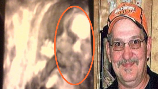 Woman finds dead father’s face in daughter-in-law’s sonogram