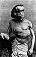 How the Elephant Man ACTUALLY looked: Staggering pics show skeleton and post-mortem bust