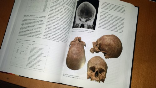 Solving the mystery of Roman London’s headless bodies